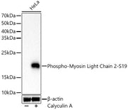 Phospho-Myosin Light Chain 2-S19 Rabbit mAb