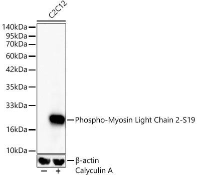 Phospho-Myosin Light Chain 2-S19 Rabbit mAb