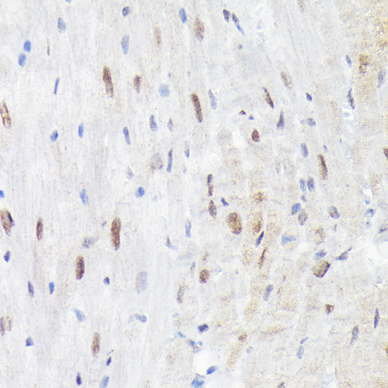 Phospho-p38 MAPK-T180 Rabbit pAb