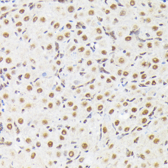 Phospho-p38 MAPK-T180 Rabbit pAb