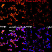 Phospho-ZAP70-Y493 Rabbit mAb