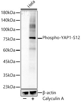 Phospho-YAP1-S127 Rabbit mAb