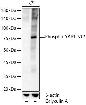 Phospho-YAP1-S127 Rabbit mAb