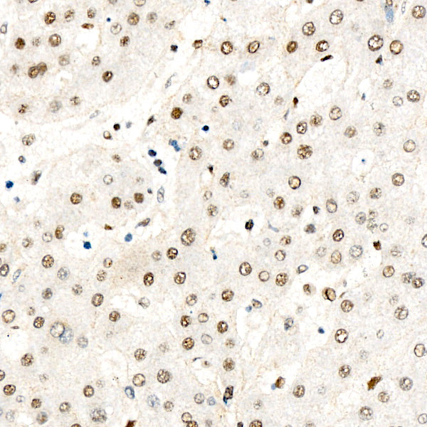 Phospho-PPP1CA-T320 Rabbit mAb