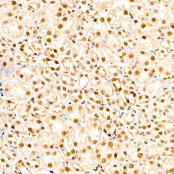 Phospho-PPP1CA-T320 Rabbit mAb