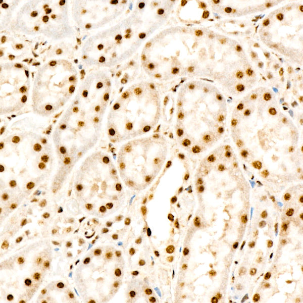 Phospho-PPP1CA-T320 Rabbit mAb