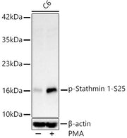 Phospho-Stathmin 1-S25 Rabbit mAb