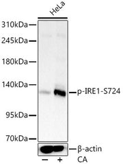 Phospho-IRE1-S724 Rabbit mAb