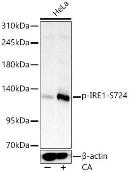 Phospho-IRE1-S724 Rabbit mAb