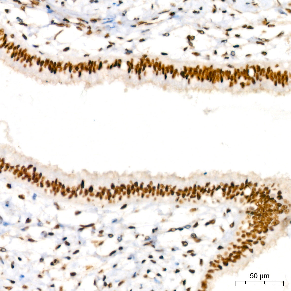 Phospho-IRE1-S724 Rabbit mAb
