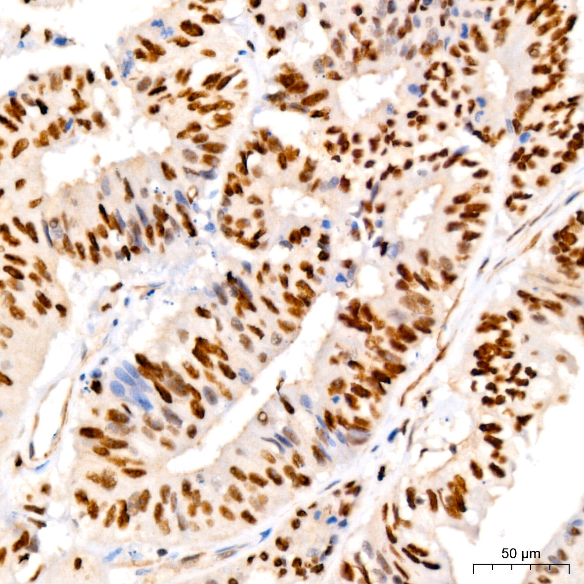 Phospho-IRE1-S724 Rabbit mAb