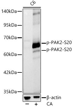 Phospho-PAK2-S20 Rabbit mAb