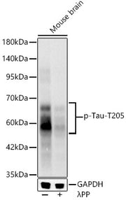 Phospho-Tau-T205 Rabbit mAb