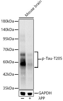 Phospho-Tau-T205 Rabbit mAb