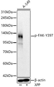 Phospho-FAK-Y397 Rabbit mAb