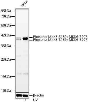 Phospho-MKK3-S189+MKK6-S207 Rabbit mAb