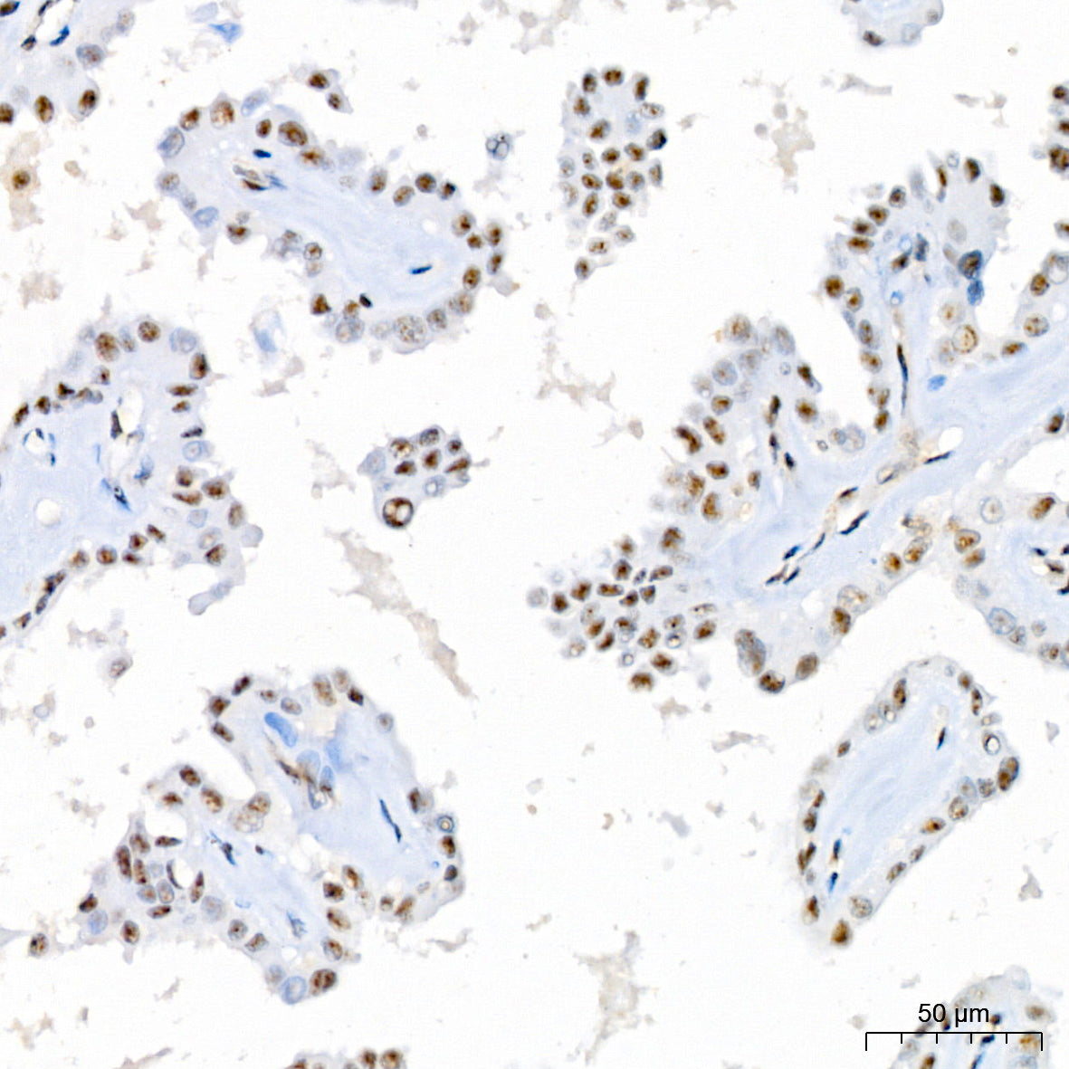 Phospho-MKK3-S189+MKK6-S207 Rabbit mAb