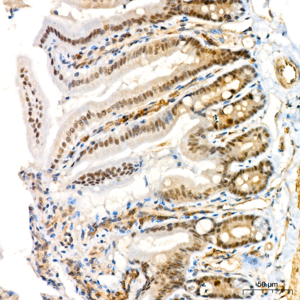 Phospho-MKK3-S189+MKK6-S207 Rabbit mAb