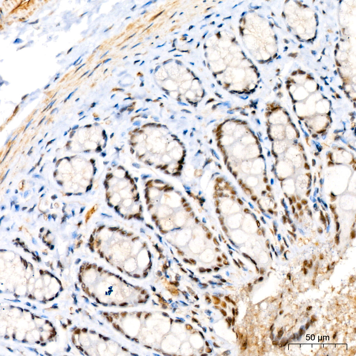 Phospho-MKK3-S189+MKK6-S207 Rabbit mAb