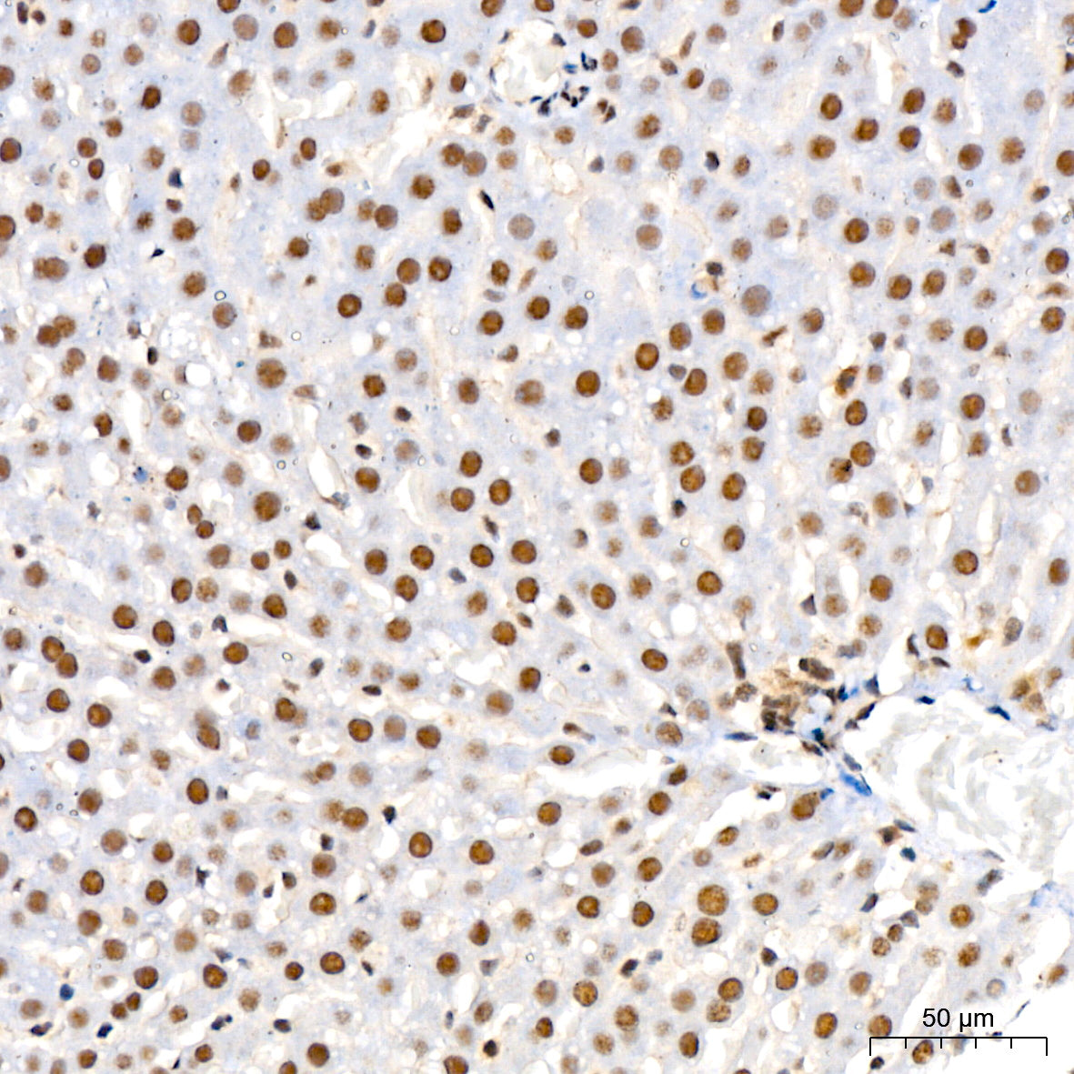 Phospho-MKK3-S189+MKK6-S207 Rabbit mAb