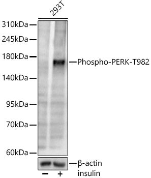 Phospho-PERK-T982 Rabbit mAb