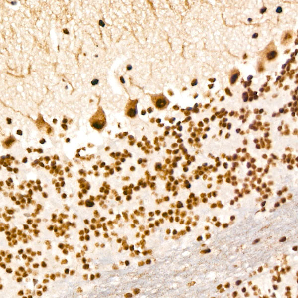 Phospho-PERK-T982 Rabbit mAb