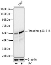 [KO Validated] Phospho-p53-S15 Rabbit mAb