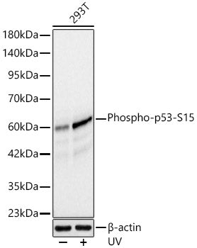 [KO Validated] Phospho-p53-S15 Rabbit mAb