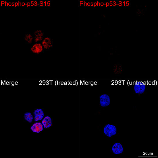 [KO Validated] Phospho-p53-S15 Rabbit mAb
