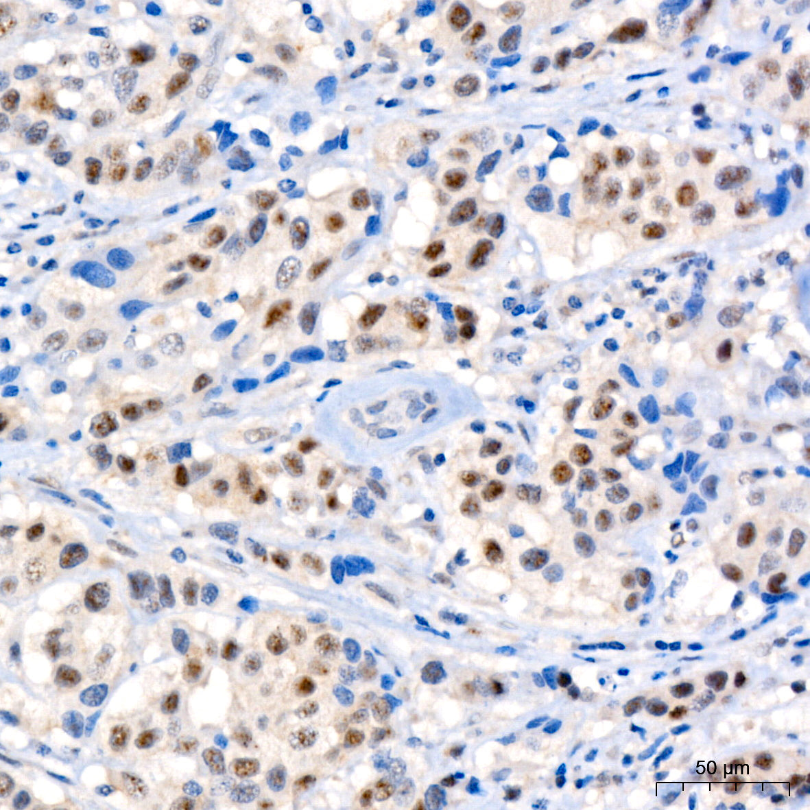 Phospho-IRS1-S612/S636 Rabbit mAb