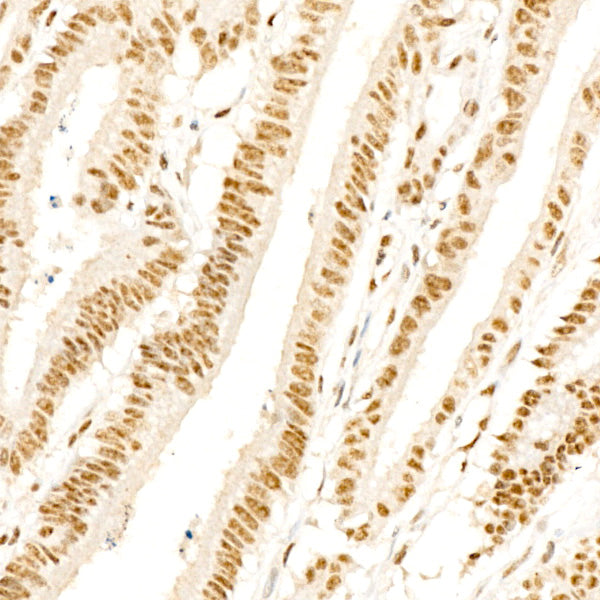 Phospho-p38 MAPK-T180 Rabbit mAb