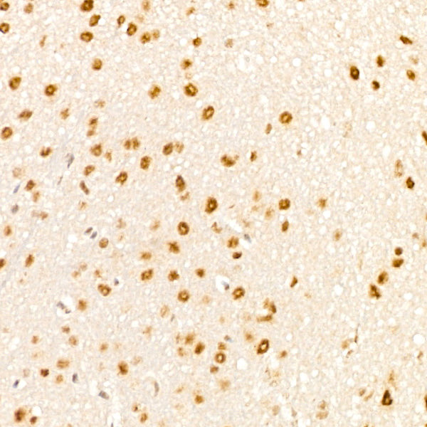 Phospho-p38 MAPK-T180 Rabbit mAb