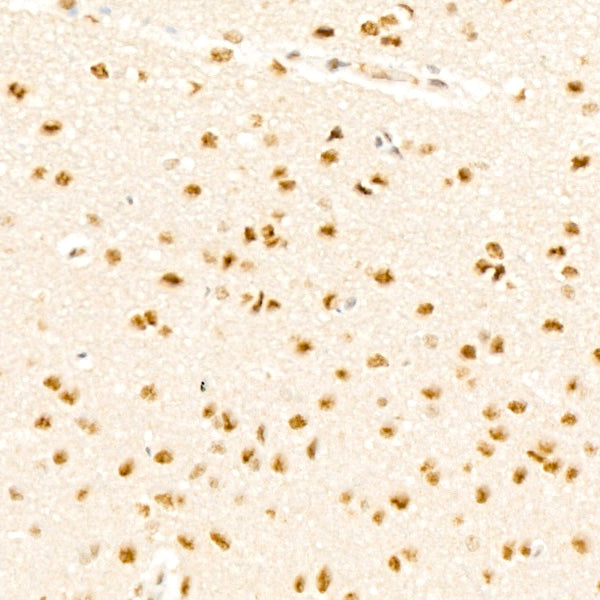 Phospho-p38 MAPK-T180 Rabbit mAb