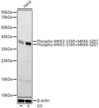 Phospho-MKK3-S189+MKK6-S207 Rabbit mAb