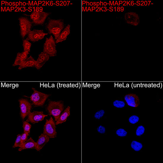 Phospho-MKK3-S189+MKK6-S207 Rabbit mAb