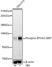 Phospho-EPHA2-S897 Rabbit mAb