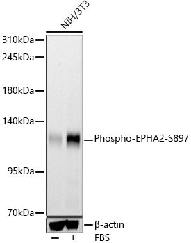 Phospho-EPHA2-S897 Rabbit mAb