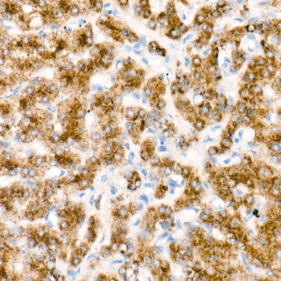 HRP-conjugated Donkey anti-Rabbit IgG (H+L)