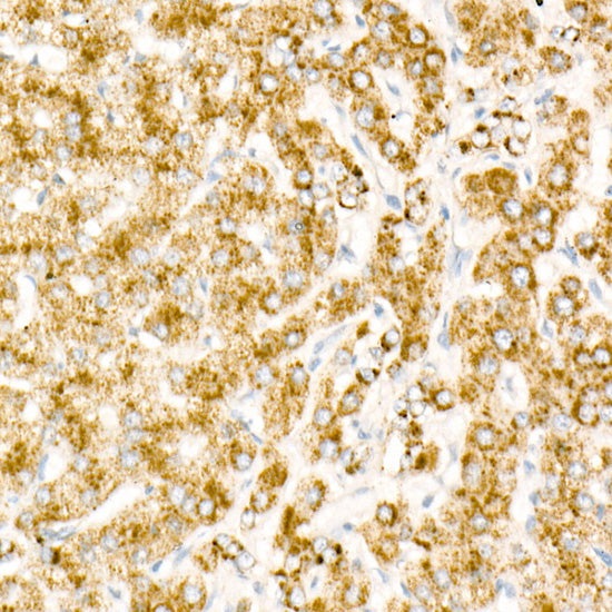 HRP-conjugated Donkey anti-Rabbit IgG (H+L)