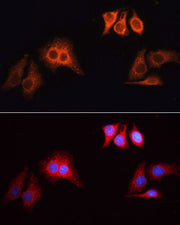 Rhodamine (TRITC)-conjugated Goat anti-Rabbit IgG (H+L)