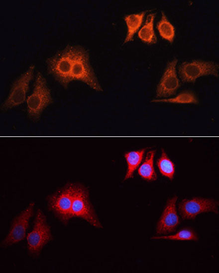 Rhodamine (TRITC)-conjugated Goat anti-Rabbit IgG (H+L)