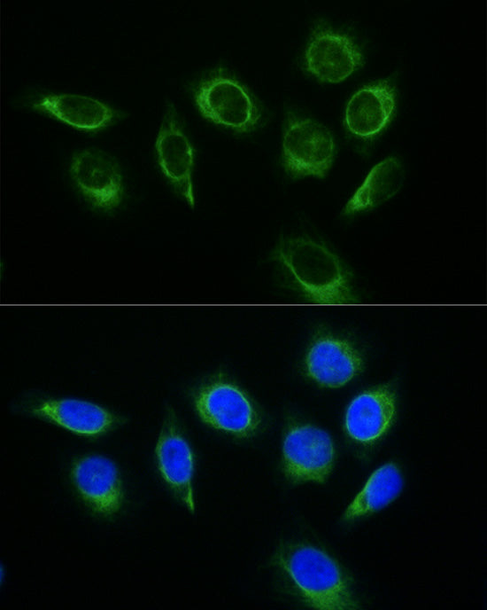 FITC-conjugated Donkey anti-Rabbit IgG (H+L)