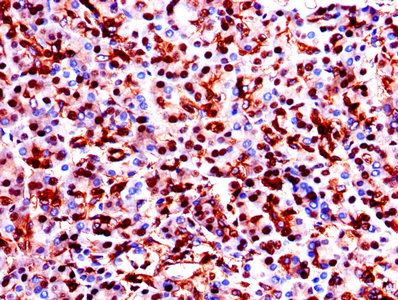 Immunofluorescent analysis of MCF-7 cells using CAC07001 at dilution of 1:100 and Alexa Fluor 488-congugated AffiniPure Goat Anti-Rabbit IgG(H+L)