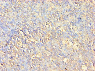 Immunofluorescence staining of Hela cells with CAC07008at 1:200, counter-stained with DAPI. The cells were fixed in 4% formaldehyde, permeabilized using 0.2% Triton X-100 and blocked in 10% normal Goat Serum. The cells were then incubated with the antibody overnight at 4°C. The secondary antibody was Alexa Fluor 488-congugated AffiniPure Goat Anti-Rabbit IgG(H+L).
