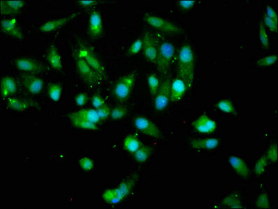 Western Blot; , Positive WB detected in: Hela whole cell lysate, A549 whole cell lysate, HepG2 whole cell lysate, MCF-7 whole cell lysate; , All lanes: AKT1 antibody at 7.4µg/ml; , Secondary; , Goat polyclonal to rabbit IgG at 1/50000 dilution; , Predicted band size: 56, 49 kDa; , Observed band size: 56, 49 kDa