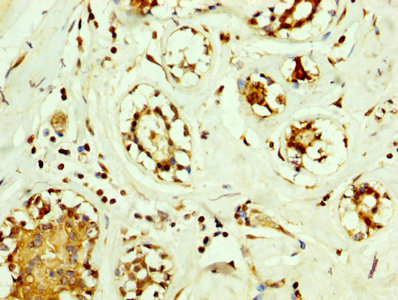 Immunofluorescence staining of Hela cells with CAC07010 at 1:250, counter-stained with DAPI. The cells were fixed in 4% formaldehyde, permeabilized using 0.2% Triton X-100 and blocked in 10% normal Goat Serum. The cells were then incubated with the antibody overnight at 4°C. The secondary antibody was Alexa Fluor 488-congugated AffiniPure Goat Anti-Rabbit IgG(H+L).