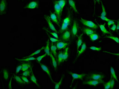 Immunoprecipitating SOD2 in K562 whole cell lysate; , Lane 1: Rabbit control IgG instead in K562 whole cell lysate. For western blotting, a HRP-conjugated Protein G antibody was used as the secondary antibody (1/2000); , Lane 2: CAC07010 (8µg) + K562 whole cell lysate (500µg); , Lane 3: K562 whole cell lysate (10µg)