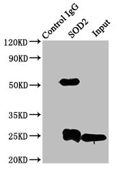 Sod2 Polyclonal Antibody - image 5