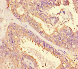 IHC image diluted at 1:500 and staining in paraffin-embedded human small intestine tissue performed on a Leica BondTM system. After dewaxing and hydration, antigen retrieval was mediated by high pressure in a citrate buffer (pH 6.0). Section was blocked with 10% normal goat serum 30min at RT. Then primary antibody (1% BSA) was incubated at 4°C overnight. The primary is detected by a biotinylated secondary antibody and visualized using an HRP conjugated SP system.