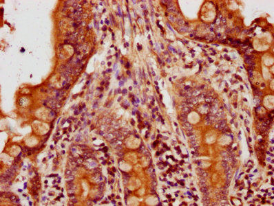 IHC image diluted at 1:500 and staining in paraffin-embedded human appendix tissue performed on a Leica BondTM system. After dewaxing and hydration, antigen retrieval was mediated by high pressure in a citrate buffer (pH 6.0). Section was blocked with 10% normal goat serum 30min at RT. Then primary antibody (1% BSA) was incubated at 4°C overnight. The primary is detected by a biotinylated secondary antibody and visualized using an HRP conjugated SP system.